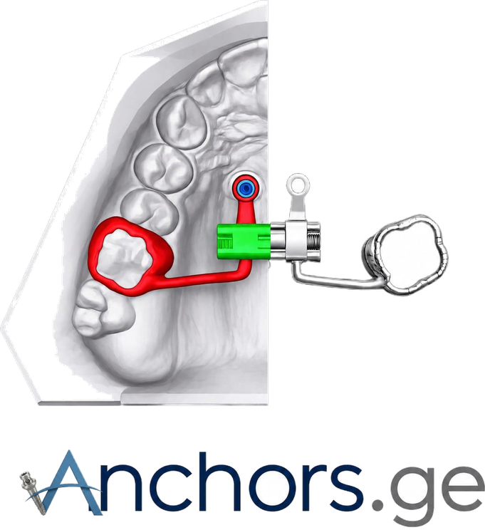 Anchors.ge